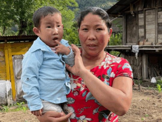 Malá Sonam je na operaci příliš slabá