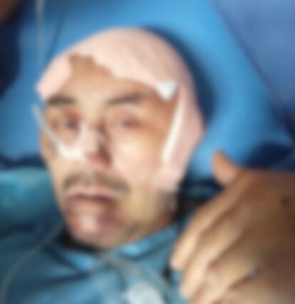 Operace hlavy pana Dhondupa