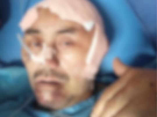 Mr. Dhondup’s head surgery